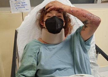 Piden apoyo para localizar a conductor que arrolló a ciclista