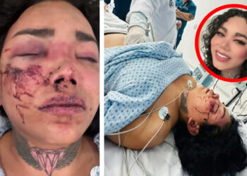 “Me agarraste a patadas”, Paola Suárez hospitalizada tras ser golpeada por su novio