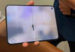 iPhone Duo: Apple enfrenta quejas por la pantalla