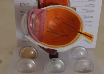 Desarrolla UPT sistema de bajo costo para mejorar imágenes de retina