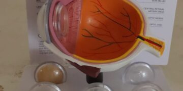 Desarrolla UPT sistema de bajo costo para mejorar imágenes de retina