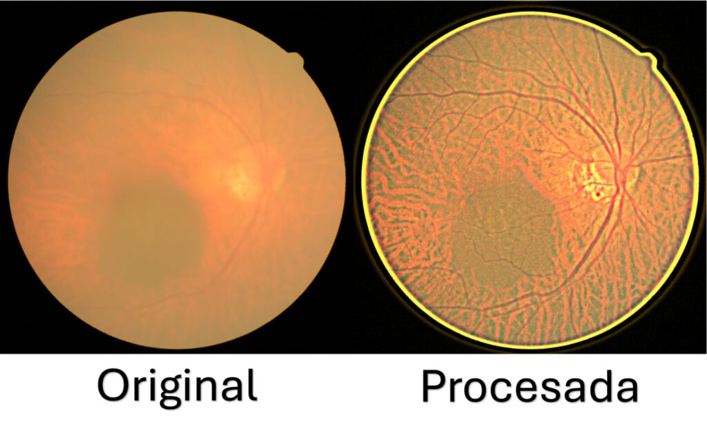 Desarrolla UPT sistema de bajo costo para mejorar imágenes de retina 